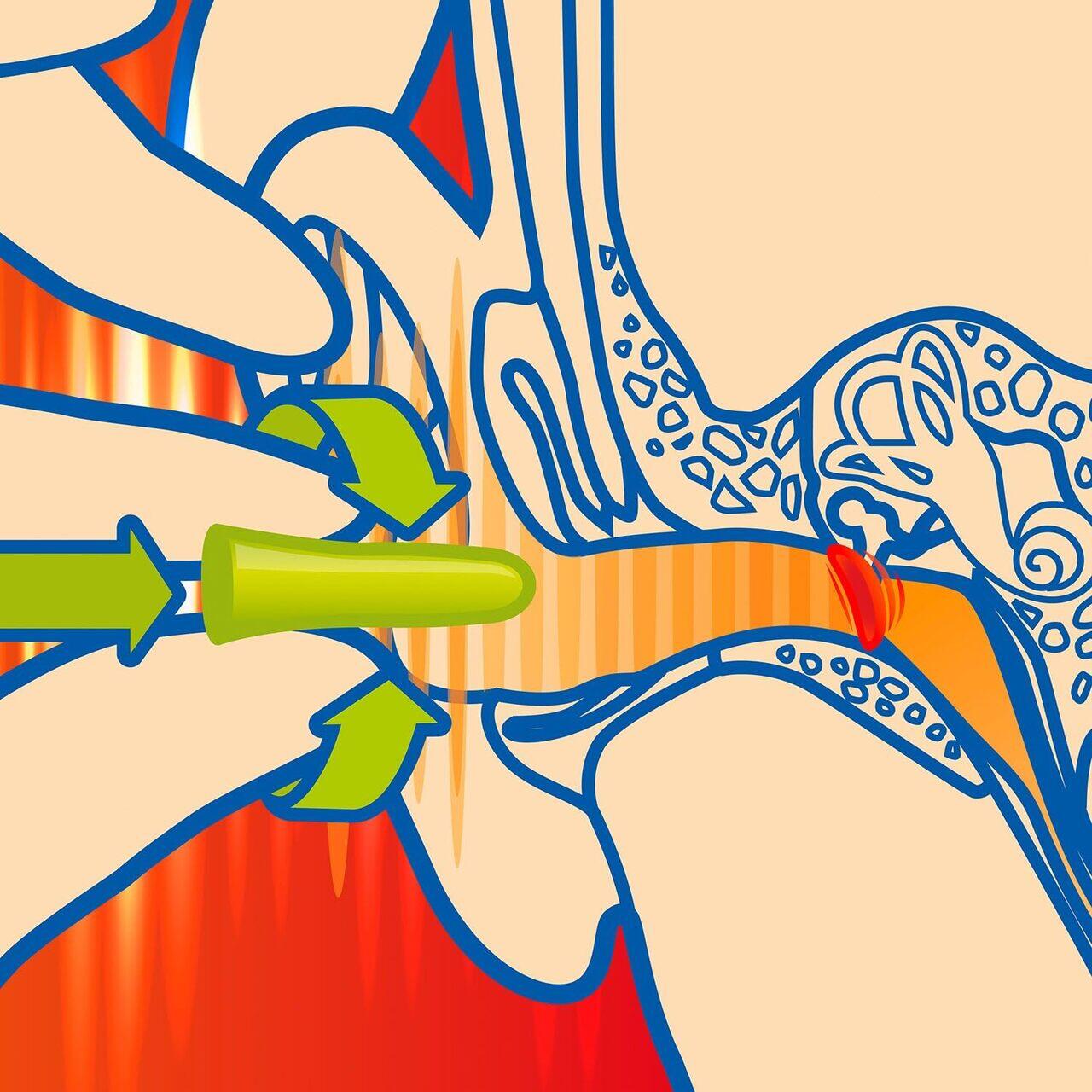 Dopuri de urechi SANOHRA Max pentru adulti, SNR 37 dB, 12 buc