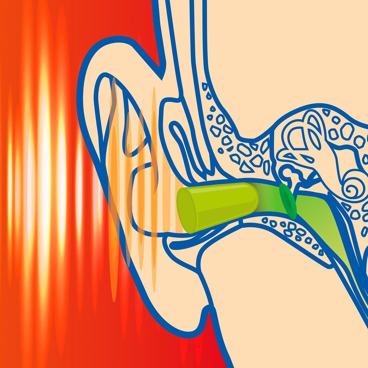 Dopuri de urechi SANOHRA Max pentru adulti, SNR 37 dB, 12 buc