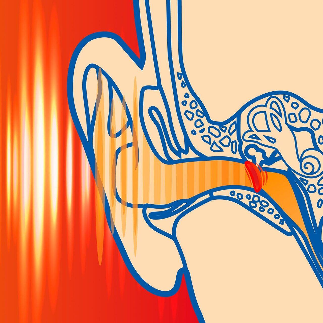 Dopuri de urechi SANOHRA Max pentru adulti, SNR 37 dB, 12 buc