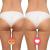 Aparat de masaj ultrasonic inSPORTline Valeri FitLine Training